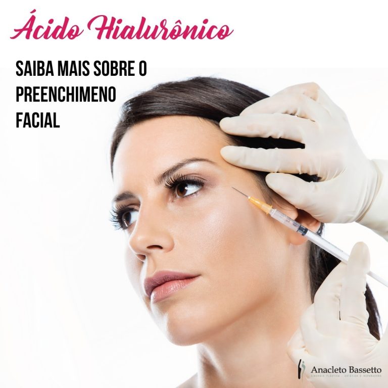 Ácido Hialurônico em Curitiba Saiba mais sobre o preenchimento facial