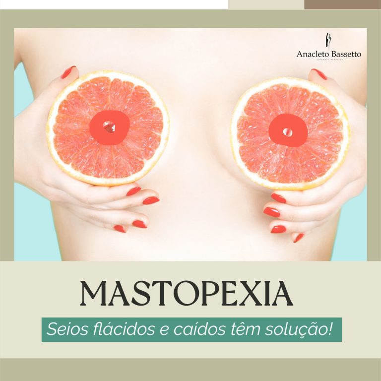 Lifting de Seios em Curitiba Cirurgia de Mastopexia