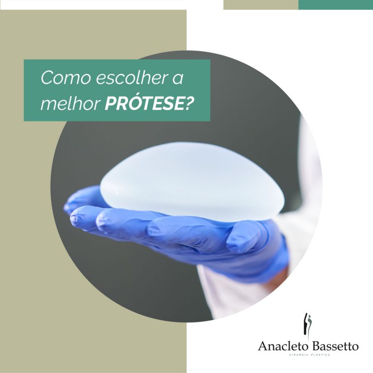 Mamoplastia de Aumento em Curitiba Como escolher a melhor prótese