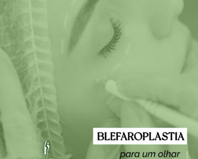 Blefaroplastia em Curitiba: Conheça mais sobre a cirurgia de pálpebras