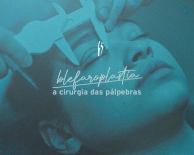 Blefaroplastia em Curitiba: Conheça mais sobre a cirurgia plástica das pálpebras