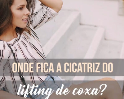 Como é a cicatriz do lifting de coxas? Cirurgia Plástica Curitiba