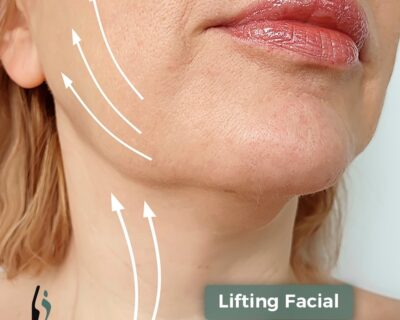 Lifting Facial em Curitiba