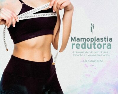 Mamoplastia Redutora em Curitiba: Entenda mais sobre a indicação deste procedimento cirúrgico