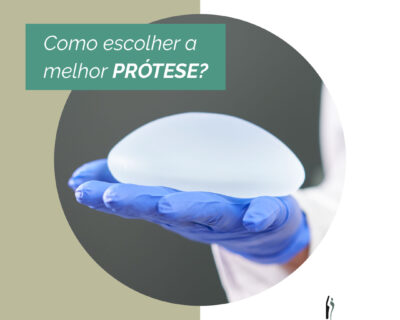 Mamoplastia de Aumento em Curitiba: Como escolher a melhor prótese?