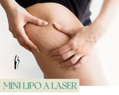 Mini Lipo a Laser em Curitiba