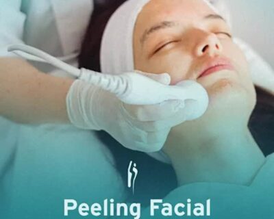 Peeling Facial em Curitiba: Conheça os três tipos de Peelings Faciais