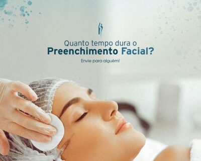 Preenchimento Facial em Curitiba: Quanto tempo dura o preenchimento facial?