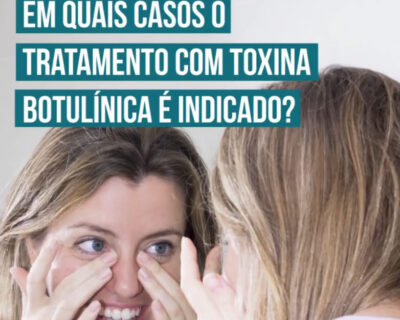 Toxina Botulínica em Curitiba: Quando o procedimento é indicado?